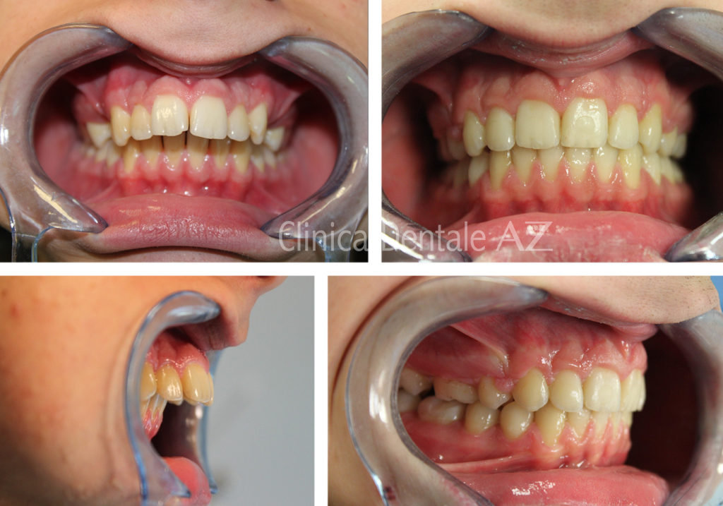 Interventi – Clinica Dentale AZ